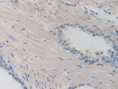 Inter Alpha-Globulin Inhibitor H1 (ITIH1) Polyclonal Antibody - image 5