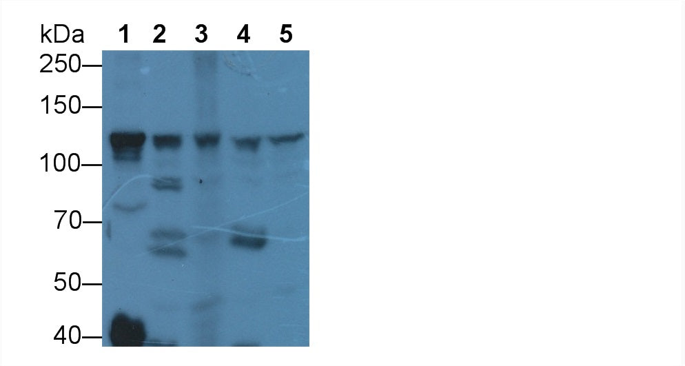 DAB staining on IHC-P; Samples: Mouse Liver Tissue; Primary Ab: 20µg/ml Rabbit Anti-Mouse ITIH4 Antibody Second Ab: 2µg/mL HRP-Linked Caprine Anti-Rabbit IgG Polyclonal Antibody