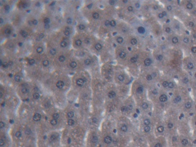 DAB staining on fromalin fixed paraffin- embedded liver tissue)