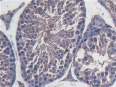 Inter Alpha-Globulin Inhibitor H4 (ITIH4) Polyclonal Antibody - image 5