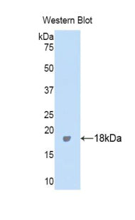 DAB staining on IHC-P; Samples: Human Liver Tissue;  Primary Ab: 20μg/ml Rabbit Anti-Human ITIH4 Antibody Second Ab: 2µg/mL HRP-Linked Caprine Anti-Rabbit IgG Polyclonal Antibody