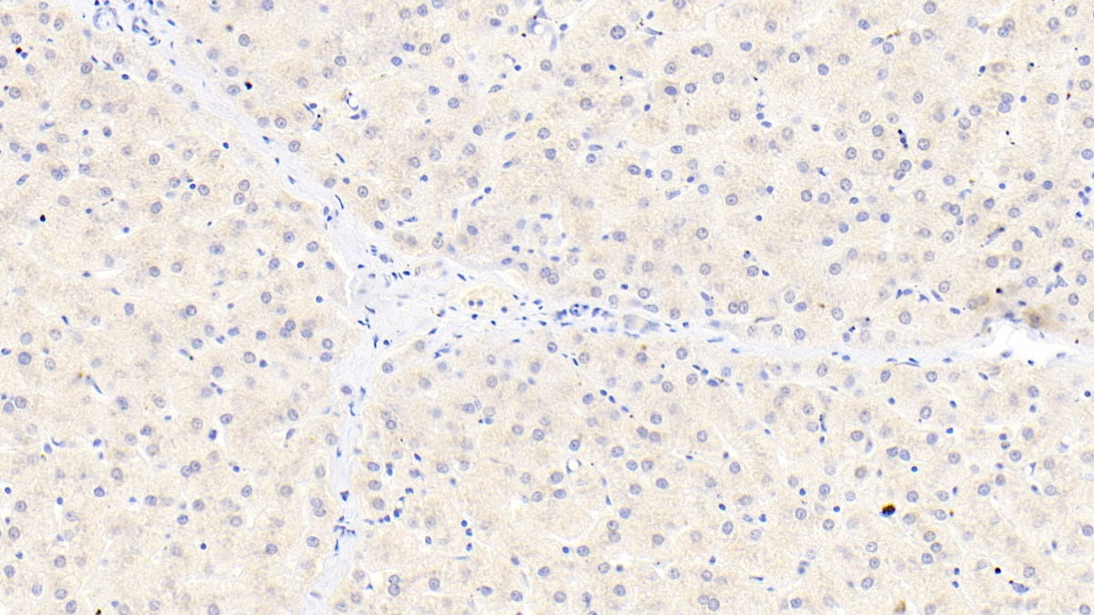 Inter Alpha-Globulin Inhibitor H4 (ITIH4) Polyclonal Antibody - image 4