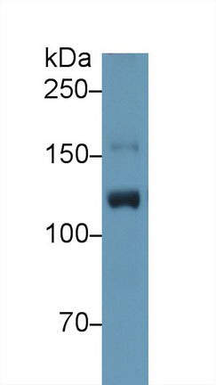 Western Blot; Sample: Recombinant protein.