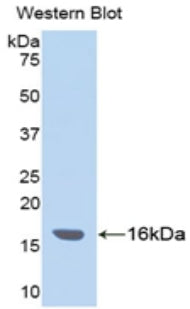 DAB staining on IHC-P; Samples: Human Liver Tissue;  Primary Ab: 20μg/ml Rabbit Anti-Human ITIH4 Antibody Second Ab: 2µg/mL HRP-Linked Caprine Anti-Rabbit IgG Polyclonal Antibody