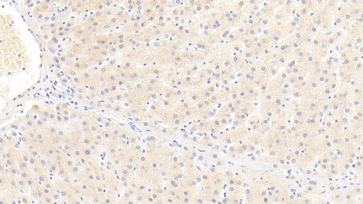 Inter Alpha-Globulin Inhibitor H4 (ITIH4) Polyclonal Antibody - image 4