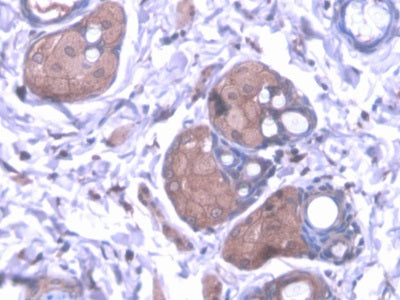 DAB staining on IHC-P; Samples: Rat Liver Tissue.