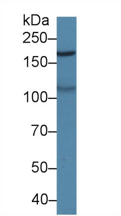 Western Blot; Sample: Recombinant protein.