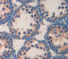 Microtubule Associated Serine/Threonine Kinase 2 (MAST2) Polyclonal Antibody - image 4