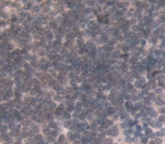 N-Methylpurine DNA Glycosylase (MPG) Polyclonal Antibody - image 3