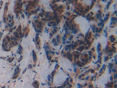 DAB staining on IHC-P; Samples: Human Thyroid Tissue.