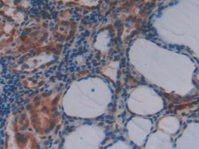 N-Methylpurine DNA Glycosylase (MPG) Polyclonal Antibody - image 5