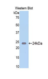 N-Acetylgalactosaminidase Alpha (NAGa) Polyclonal Antibody - image 2