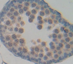 N-Acetylgalactosaminidase Alpha (NAGa) Polyclonal Antibody - image 3