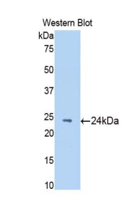 Western Blot; Sample: Rat Testis lysate; ; Primary Ab: 3µg/ml Rabbit Anti-Rat NAGa Antibody; Second Ab: 0.2µg/mL HRP-Linked Caprine Anti-Rabbit IgG Polyclonal Antibody;