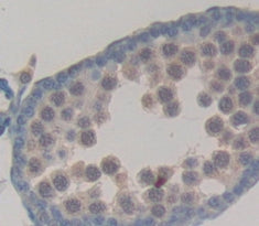 N-Acetylgalactosaminidase Alpha (NAGa) Polyclonal Antibody - image 4