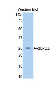 N-Acetylgalactosaminidase Alpha (NAGa) Polyclonal Antibody - image 2