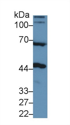 Western Blot; Sample: Recombinant protein.