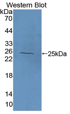 DAB staining on IHC-P; Samples: Human Kidney Tissue; Primary Ab: 20μg/ml Rabbit Anti-Human NAGa Antibody Second Ab: 2µg/mL HRP-Linked Caprine Anti-Rabbit IgG Polyclonal Antibody