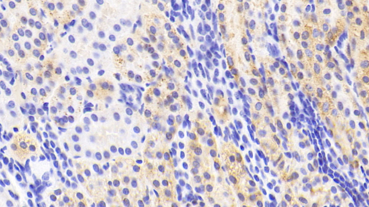 DAB staining on IHC-P. Samples: Human Tissue)