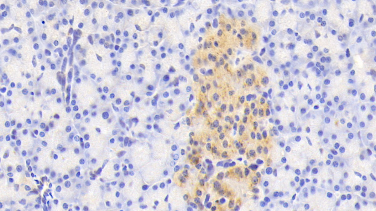 N-Acetylgalactosaminidase Alpha (NAGa) Polyclonal Antibody - image 5