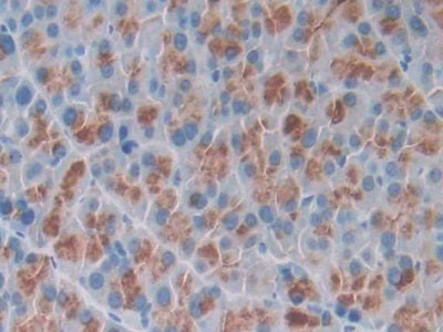 DAB staining on fromalin fixed paraffin- embedded Kidney tissue)