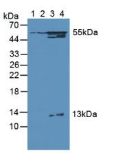 Western Blot; Sample: Recombinant OXCT1, Human.