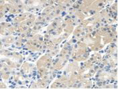 3-Oxoacid Coenzyme A Transferase 1 (OXCT1) Polyclonal Antibody - image 5