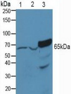 Knockout Varification: ; Lane 1: Wild-type Hela cell lysate; ; Lane 2: PAK1 knockout Hela cell lysate; ; Predicted MW: 61kd ; Observed MW: 65kd; Primary Ab: 3µg/ml Rabbit Anti-Human PAK1 Antibody; Second Ab: 0.2µg/mL HRP-Linked Caprine Anti-Rabbit IgG Polyclonal Antibody;