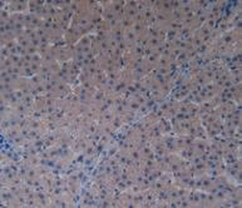 p21 Protein Activated Kinase 1 (PAK1) Polyclonal Antibody - image 5