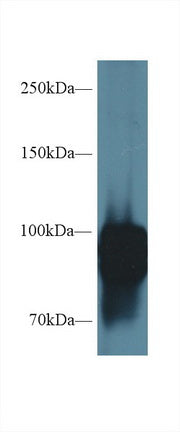 Western Blot; Sample: Recombinant protein.