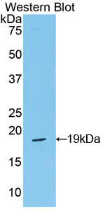 DAB staining on IHC-P; Samples: Rat Lung Tissue;  Primary Ab: 20µg/ml Rabbit Anti-Rat POSTN Antibody