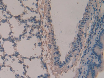 DAB staining on IHC-P; Samples: Rat Lung Tissue)