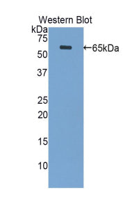 Periplakin (PPL) Polyclonal Antibody - image 2