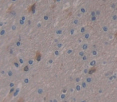 Periplakin (PPL) Polyclonal Antibody - image 3