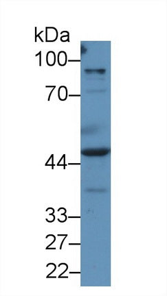 Western Blot; Sample: Recombinant protein.