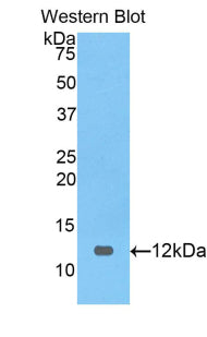 DAB staining on IHC-P; Samples: Human Small intestine Tissue; Primary Ab: 20μg/ml Rabbit Anti-Human PRAME Antibody Second Ab: 2µg/mL HRP-Linked Caprine Anti-Rabbit IgG Polyclonal Antibody