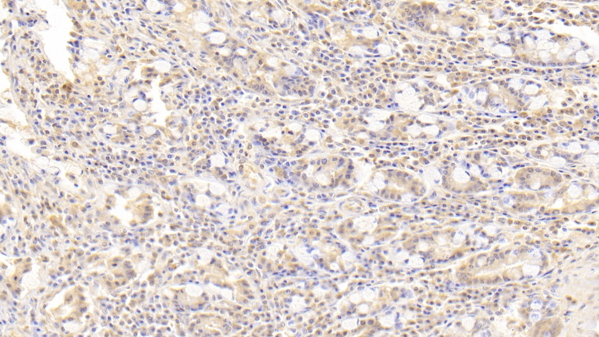 DAB staining on IHC-P. Samples: Human Tissue)