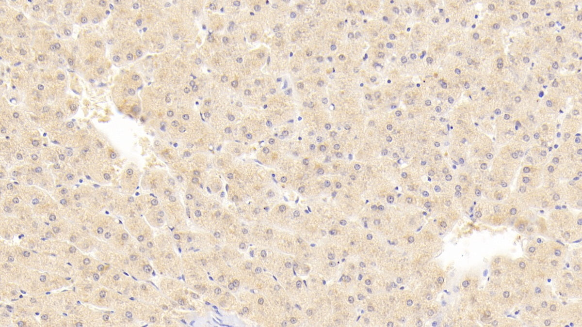 Preferentially Expressed Antigen In Melanoma (PRAME) Polyclonal Antibody - image 5