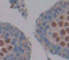 Protamine 1 (PRM1) Polyclonal Antibody - image 3
