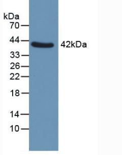 Western Blot; Sample: Recombinant QPCT, Human.