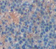 Glutaminyl Peptide Cyclotransferase (QPCT) Polyclonal Antibody - image 4