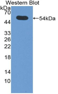 Sialic Acid Acetylesterase (SIAE) Polyclonal Antibody - image 2