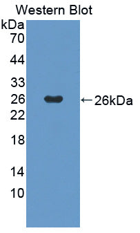 Suppressors Of Cytokine Signaling 2 (SOCS2) Polyclonal Antibody - image 2