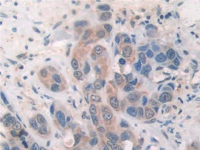 DAB staining on fromalin fixed paraffin-embedded stomach tissue)