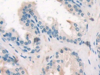 Suppressors Of Cytokine Signaling 2 (SOCS2) Polyclonal Antibody - image 4