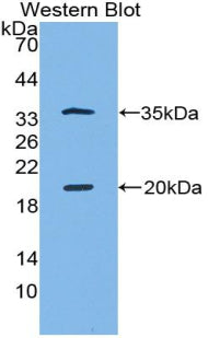 Serine Peptidase Inhibitor Kazal Type 5 (SPINK5) Polyclonal Antibody - image 2