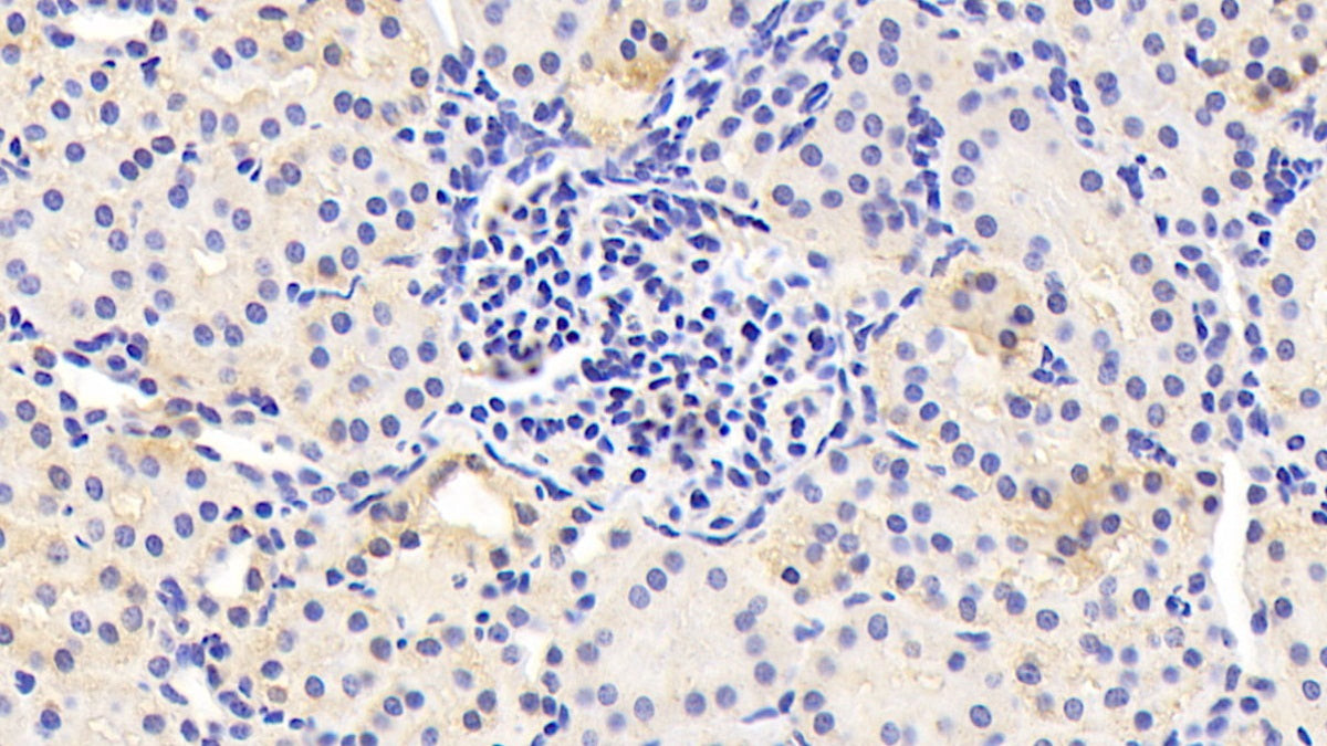 DABstainingonIHC-P.Samples:HumanTissue)