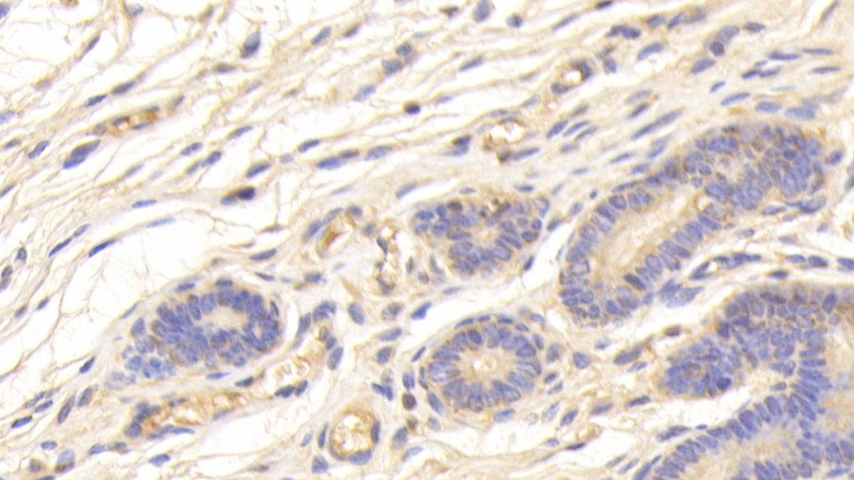 Serine Peptidase Inhibitor Kazal Type 5 (SPINK5) Polyclonal Antibody - image 4