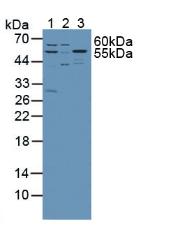 Knockout Varification: ; Lane 1: Wild-type Jurkat cell lysate; ; Lane 2: SPTLC1 knockout Jurkat cell lysate; ; Predicted MW: 53kd ; Observed MW: 55kd; Primary Ab: 1µg/ml Rabbit Anti-Mouse SPTLC1 Antibody; Second Ab: 0.2µg/mL HRP-Linked Caprine Anti-Rabbit IgG Polyclonal Antibody;