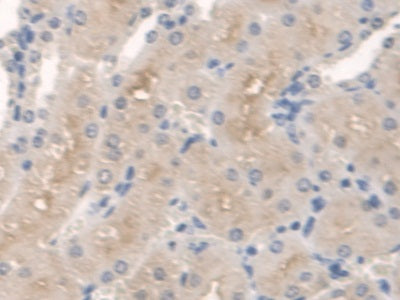 DAB staining on IHC-P; Samples: Mouse Liver Tissue.